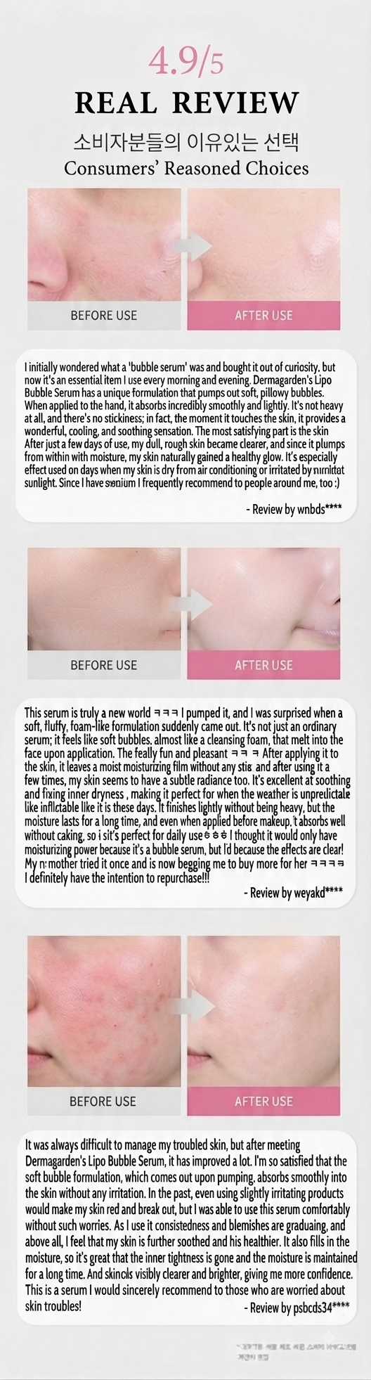 Dermagarden Lipo Bubble Serum - Real Reviews Before & After